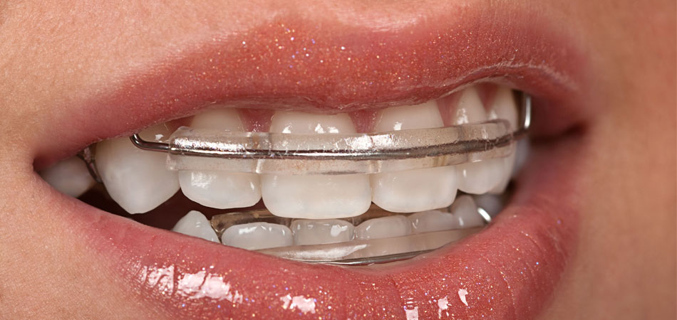 Deep Dental Care Ahmedabad Dentist In Ahmedabad Dental Clinic